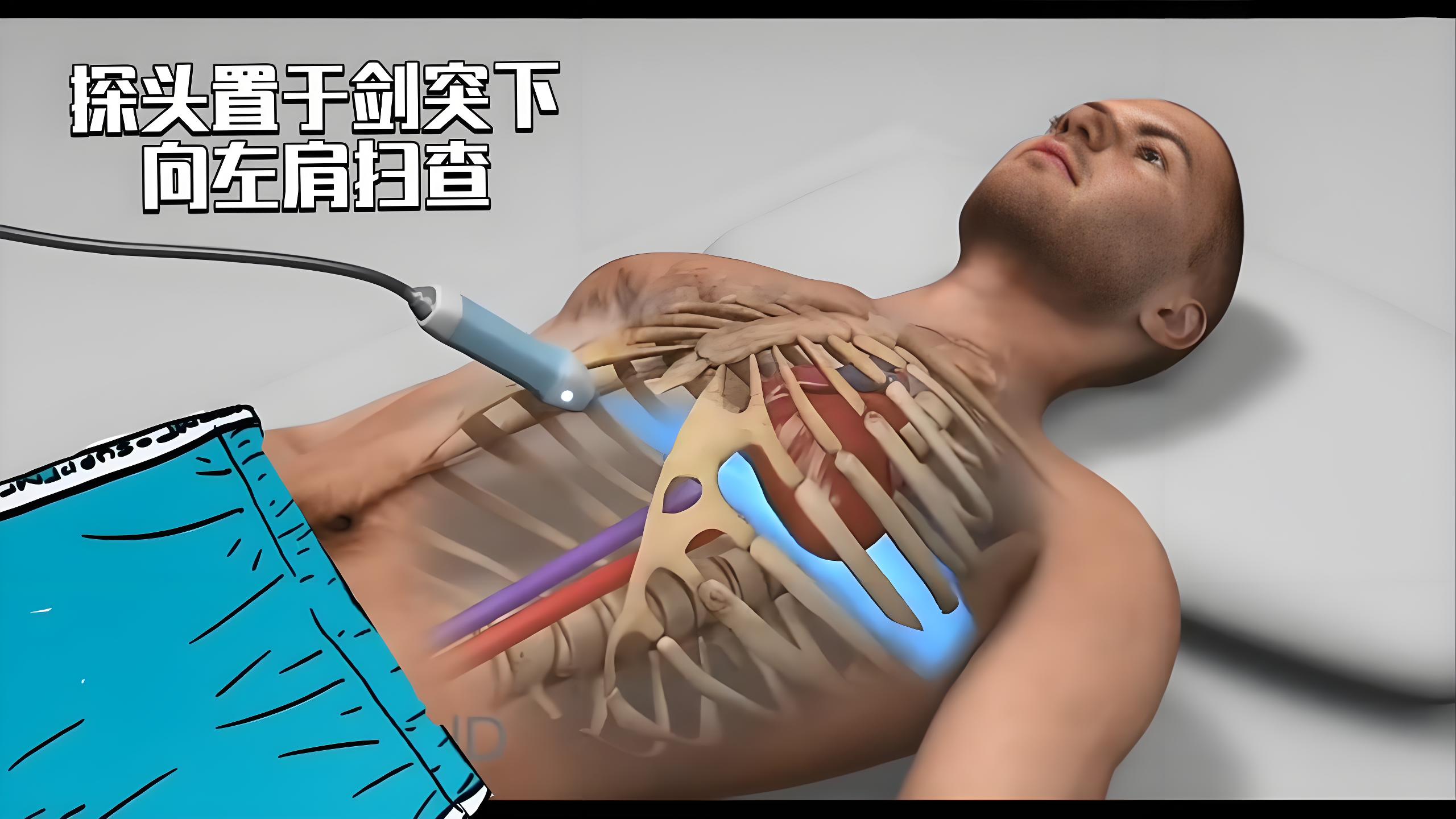 心脏超声-四腔心切面（心尖及剑突下四腔心）3D心脏解剖