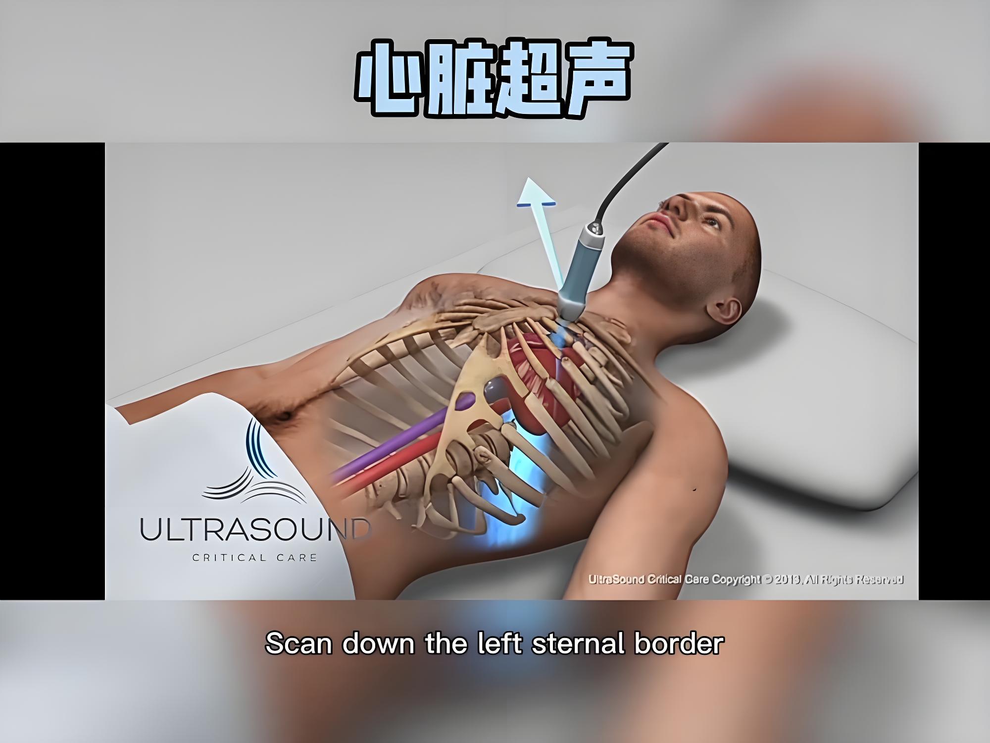心超三部位切面演示